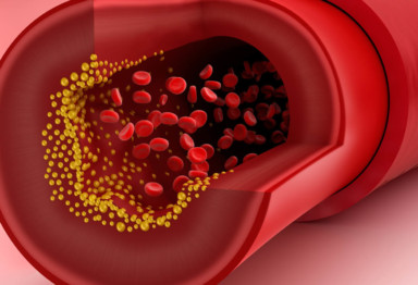 cholesterol levels and heart disease