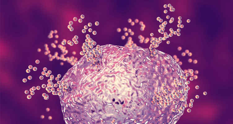 histamines and fermented food