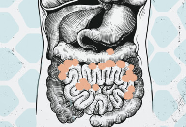 visceral fat around organs