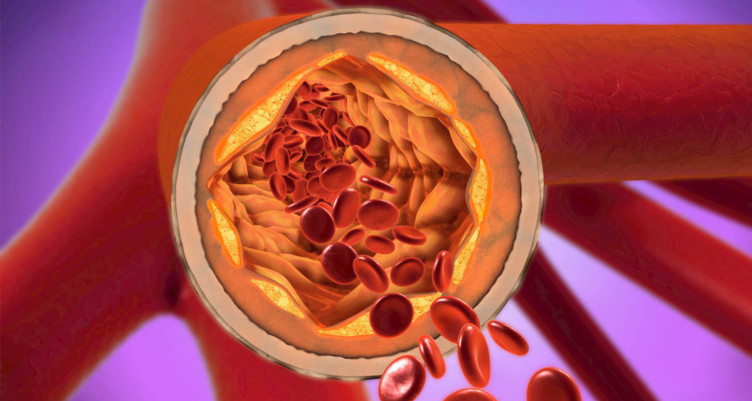 saturated fat bad reputation