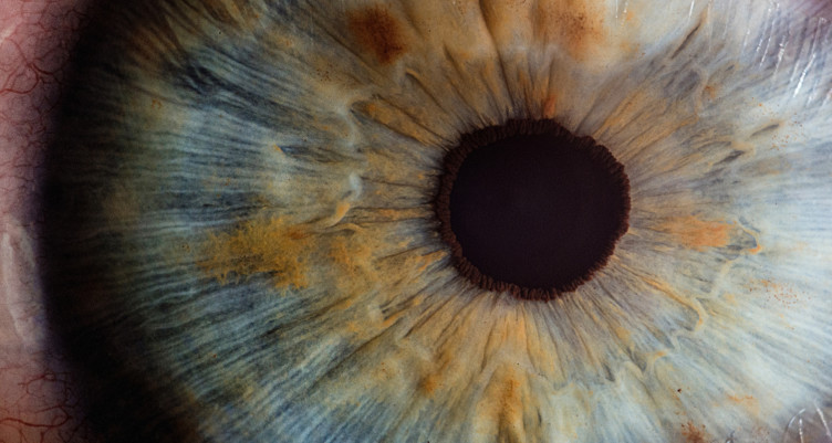 Closeup of eye